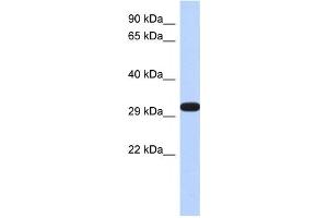 Western Blotting (WB) image for anti-Dimethylarginine Dimethylaminohydrolase 2 (DDAH2) antibody (ABIN2460078) (DDAH2 antibody)