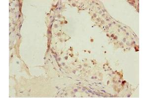 Immunohistochemistry of paraffin-embedded human testis tissue using ABIN7153074 at dilution of 1:100 (FOXN2 antibody  (AA 172-431))
