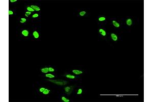 Immunofluorescence of purified MaxPab antibody to XRCC6 on HeLa cell. (XRCC6 antibody  (AA 1-609))