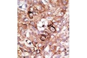 Image no. 1 for anti-BCL2-Associated Agonist of Cell Death (BAD) (AA 100-130), (BH3 Domain) antibody (ABIN356836) (BAD antibody  (BH3 Domain))