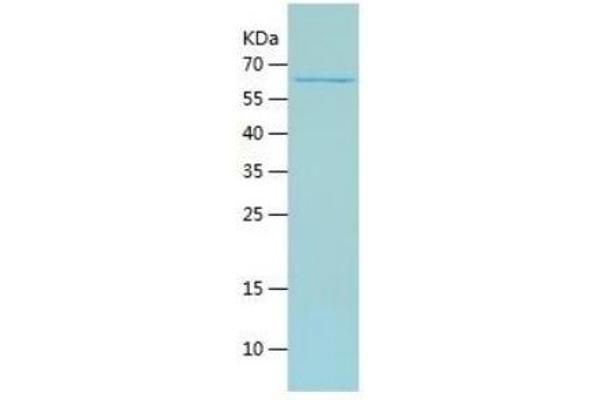 TEAD4 Protein (AA 74-434) (His-IF2DI Tag)