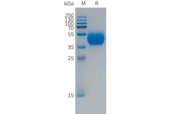 FCRL5 Protein (Fc Tag)