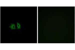 Immunofluorescence analysis of A549 cells, using FZD5 Antibody. (FZD5 antibody  (AA 461-510))