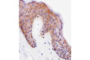 Immunohistochemical analysis of paraffin-embedded H. (PITPNA antibody  (C-Term))