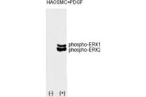 Western Blotting (WB) image for anti-Mitogen-Activated Protein Kinase 1/3 (MAPK1/3) (pThr202), (pTyr204) antibody (ABIN3001885) (ERK1/2 antibody  (pThr202, pTyr204))