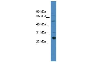 WB Suggested Anti-ZMAT2 Antibody Titration:  0. (ZMAT2 antibody  (Middle Region))