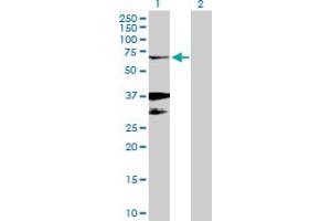 Western Blot analysis of EGR2 expression in transfected 293T cell line by EGR2 MaxPab polyclonal antibody. (EGR2 antibody  (AA 1-476))