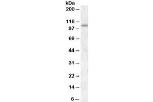 Western blot testing of NIH3T3 lysate with IA2 antibody at 0. (PTPRN antibody)