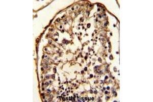 Immunohistochemistry (IHC) image for anti-Tubulin, beta (TUBB) antibody (ABIN5014943) (TUBB antibody)