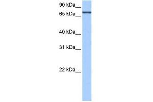 ADAD2 antibody used at 0. (ADAD2 抗体  (C-Term))