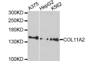 Western blot analysis of extracts of various cell lines, using COL11A2 antibody. (COL11A2 antibody  (AA 210-380))