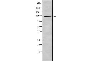 Western blot analysis of TRPV3 using HeLa whole cell lysates (TRPV3 antibody  (N-Term))