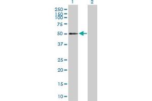 Western Blot analysis of CD177 expression in transfected 293T cell line by CD177 MaxPab polyclonal antibody. (CD177 antibody  (AA 1-437))