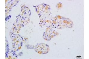 Formalin-fixed and paraffin embedded human placenta tissue labeled with Anti VEGF-B Polyclonal Antibody, Unconjugated (ABIN736313) at 1:200 followed by conjugation to the secondary antibody and DAB staining (VEGFB antibody)