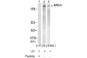 Image no. 2 for anti-Breast Cancer 1 (BRCA1) (Ser1423) antibody (ABIN197481) (BRCA1 antibody  (Ser1423))