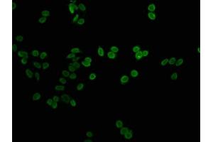 Immunofluorescence staining of HepG2 cells with nme1HU at 1:1, counter-stained with DAPI. (Histone H1-Like (LOC107807853) antibody)