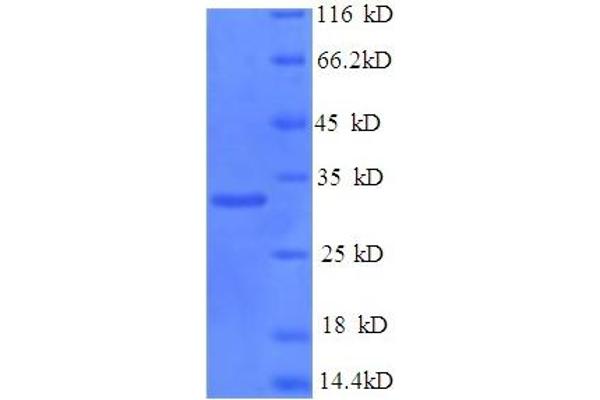 NKTR Protein (AA 10-175) (His-SUMO Tag)