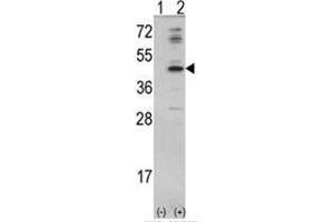 Western blot analysis of MVD (arrow) using rabbit polyclonal MVD Antibody (N-term) . (MVD antibody  (N-Term))