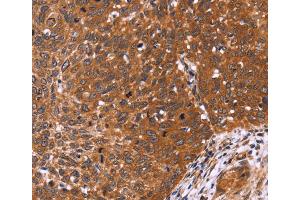 Immunohistochemistry (IHC) image for anti-Cell Division Cycle 37-Like 1 (CDC37L1) antibody (ABIN2423121) (CDC37L1 antibody)