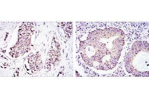 Immunohistochemistry (IHC) image for anti-Heat Shock 60kDa Protein 1 (Chaperonin) (HSPD1) antibody (ABIN969200)