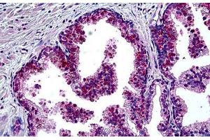 Human Prostate: Formalin-Fixed, Paraffin-Embedded (FFPE) (MSH6 antibody  (AA 2-14))