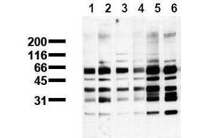 Western Blotting (WB) image for anti-Phosphoserine antibody (ABIN126866) (Phosphoserine antibody)