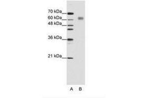 Image no. 2 for anti-Eukaryotic Translation Initiation Factor 4B (EIF4B) (AA 490-539) antibody (ABIN202813) (EIF4B antibody  (AA 490-539))