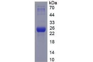 SDS-PAGE analysis of Mouse HSPA5 Protein. (GRP78 Protein)