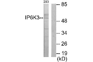 Immunohistochemistry analysis of paraffin-embedded human brain tissue using IP6K3 antibody. (IP6K3 antibody)