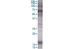 Western Blotting (WB) image for HDAC1 293T Cell Transient Overexpression Lysate(Denatured) (ABIN1332095)