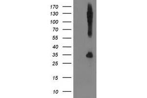 Western Blotting (WB) image for anti-Synaptosomal-Associated Protein, 25kDa (SNAP25) antibody (ABIN1501018) (SNAP25 antibody)