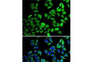Immunofluorescence analysis of A-549 cells using USP8 Polyclonal Antibody (USP8 antibody)