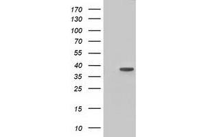 HEK293T cells were transfected with the pCMV6-ENTRY control (Left lane) or pCMV6-ENTRY HIBCH (Right lane) cDNA for 48 hrs and lysed. (HIBCH antibody)