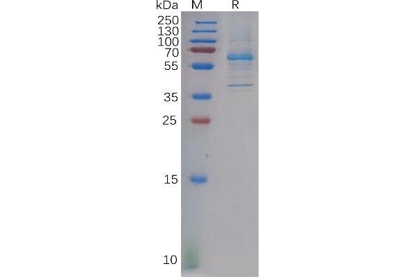 DKK2 Protein (AA 34-259) (Fc Tag)