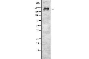 Western blot analysis of MYH9 using Jurkat whole cell lysates (Myosin 9 antibody  (Internal Region))