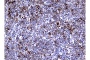 Image no. 1 for anti-Fc Fragment of IgE, Low Affinity II, Receptor For (CD23) (FCER2) (AA 48-321) antibody (ABIN1491553) (FCER2 antibody  (AA 48-321))