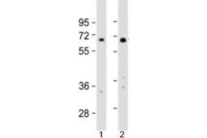 Western blot testing of human 1) HeLa and 2) HT-1080 cell lysate with IL4I1 antibody at 1:2000. (IL4I1 antibody  (AA 391-422))