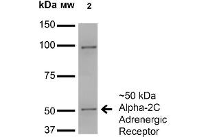 ADRA2C抗体（AA 442-462）（HRP）