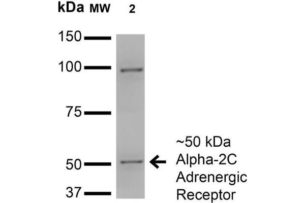 ADRA2C抗体（AA 442-462）（HRP）