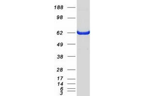 CARM1 Protein (Myc-DYKDDDDK Tag)