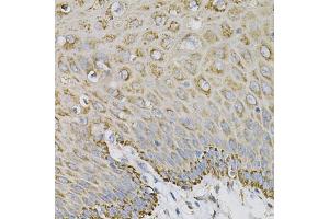 Immunohistochemistry of paraffin-embedded human esophagus using EFNA1 Antibody (ABIN5973078) at dilution of 1/100 (40x lens). (Ephrin A1 antibody)