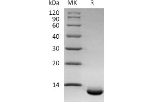 Greater than 95 % as determined by reducing SDS-PAGE. (CXCL6 Protein (His tag))
