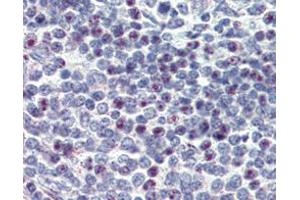 Figur： Immunohistochemical analysis of paraffin-embedded human spleen using CD34 mouse mAb with DAB staining. (CD34 antibody)