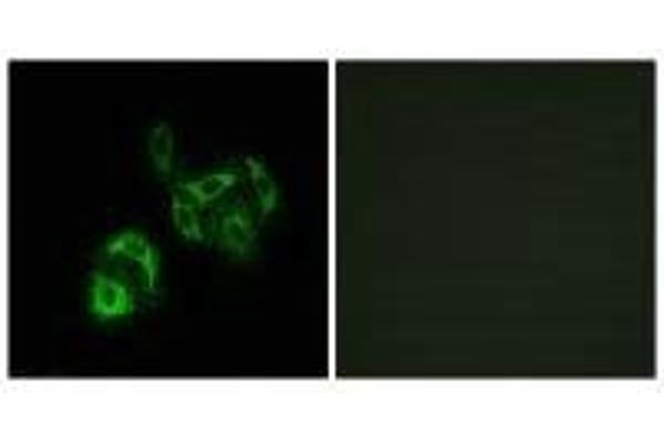 SLC27A4 antibody