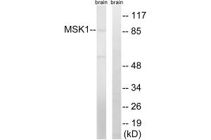 Western blot analysis of extracts from mouse brain cells, using MSK1 (epitope around residue 212) antibody. (MSK1 antibody  (Ser212))
