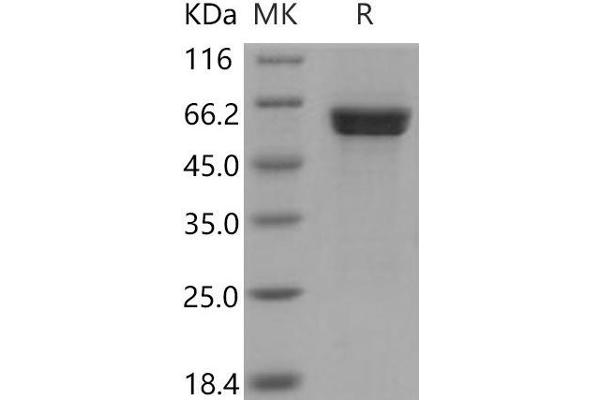 CAMK1D Protein (GST tag)