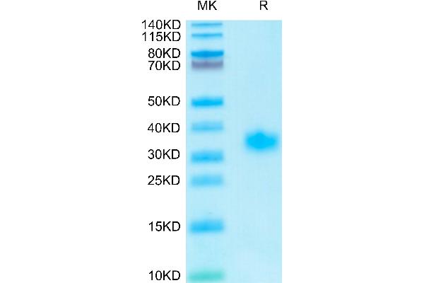 ADIPOQ Protein (AA 19-244) (His tag)