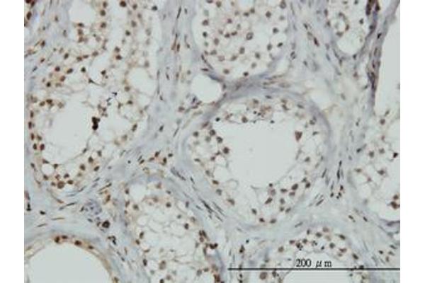 ZNF85 antibody  (AA 2-77)