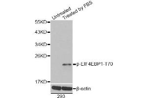 Western blot analysis of extracts of 293 cells, using Phospho-EIF4EBP1-T70 antibody (ABIN5995639). (eIF4EBP1 antibody  (pThr69))