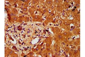 IHC image of ABIN7164887 diluted at 1:200 and staining in paraffin-embedded human liver tissue performed on a Leica BondTM system. (PTOV1 antibody  (AA 2-137))